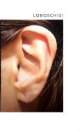 Operazione orecchie (Otoplastica) - Foto del prima - Dott. Francesco Lino