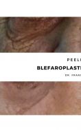Blefaroplastica - Foto del prima - Dott. Francesco Lino