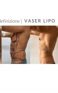 Liposuzione addome - Foto del prima - Dott. Francesco Lino