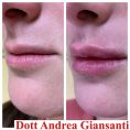 Dott. Andrea Giansanti - Foto del prima - Dott. Andrea Giansanti