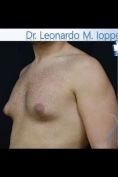Dott. Leonardo Michele Ioppolo Md - Foto del prima - Dott. Leonardo Michele Ioppolo Md