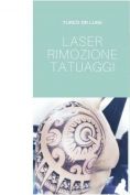 Rimozione tatuaggi - laser - Foto del prima - Dott. Luigi Turco