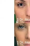Dott. Massimo Re - Chirurgo plastico ed estetico - Foto del prima - Dott. Massimo Re - Chirurgo plastico ed estetico