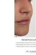 Aumento labbra - Foto del prima - Dott.  Alfredo Colapietra