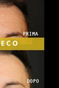 Juneco Cliniche di Medicina e Chirurgia Estetica - Foto del prima - Juneco Cliniche di Medicina e Chirurgia Estetica