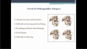What is Orthognathic Surgery 