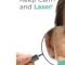 Acne laser, Cicatrici da acne laser