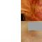 Procedure laser in dermatologia estetica