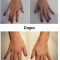 Mesoterapia (rivitalizzazione del viso, collo, decoltè, mani)