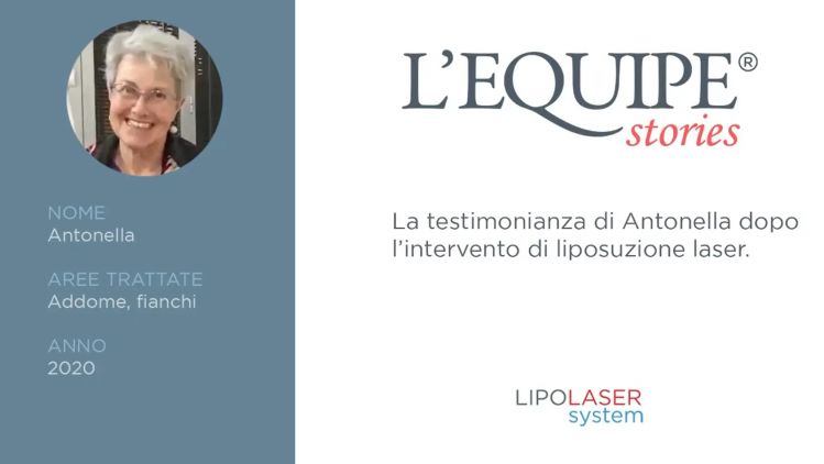 Testimonianza di Antonella dopo Liposuzione laser Addome e Fianchi