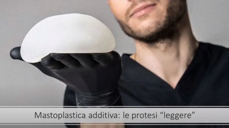 Mastoplastica additiva con protesi leggere: la vera innovazione degli ultimi 20 anni | Dr Montemurro