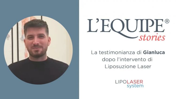 Testimonianza di Gianluca dopo intervento di liposuzione laser ai fianchi