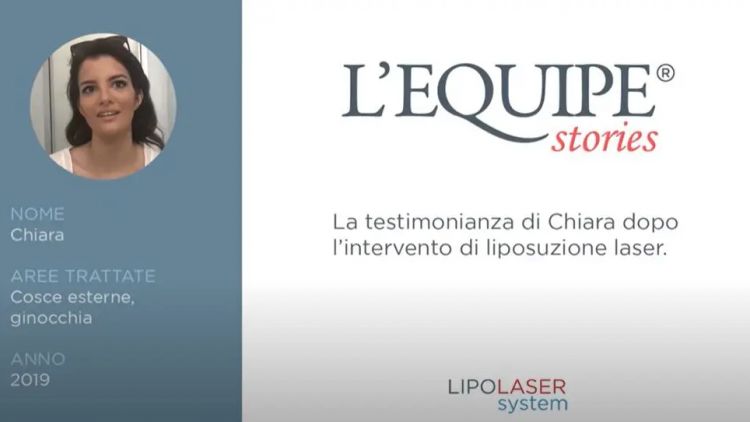 Testimonianza di Chiara post Liposuzione laser Cosce esterne e Ginocchia